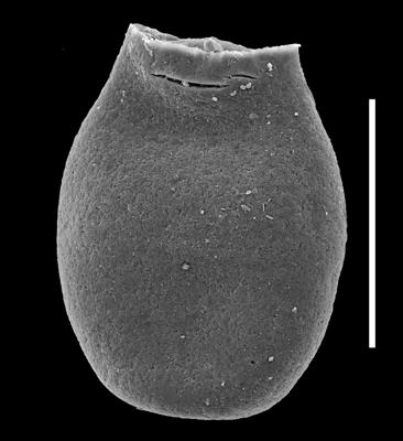 <i><i>Chitinozoa</i> | Desmochitina sp. group minor Eisenack, 1931</i><br />Museum of Art excavation section, Kadriorg, 0.30 m, Hunneberg Stage ( 424-66)