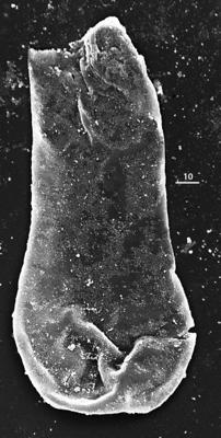 <i><i>Chitinozoa</i> | "Vitreachitina" sp. 2 , Nestor, 1994</i><br />Aizpute 41 borehole, 964.60 m, lower Silurian ( 345-19)