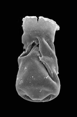 <i><i>Chitinozoa</i> | Bursachitina sp. 1 Mullins et Loydell, 2001</i><br />Ventspils D-3 borehole, 815.00 m, Telychian ( 423-16)