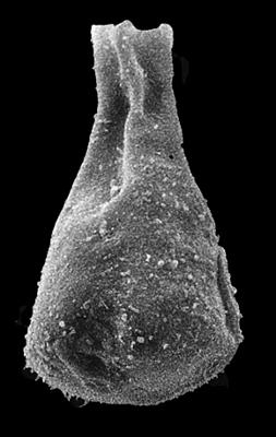 <i><i>Chitinozoa</i> | Sphaerochitina? sp.</i><br />Ohesaare borehole, 161.20 m, Jaagarahu Stage ( 527-8)