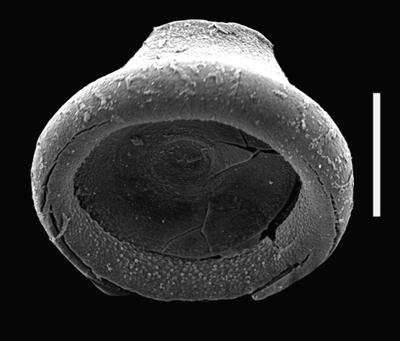 <i><i>Chitinozoa</i> | Bulbochitina? sp.</i><br />Ventspils D-3 borehole, 290.10 m, Přidoli ( 607-67)