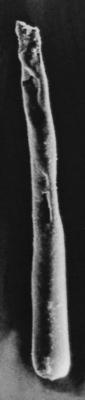 <i><i>Conochitina</i> | Conochitina cf. leptosoma Laufeld, 1974</i><br />Ruhnu 500 borehole, 392.80 m, Jaagarahu Stage ( 272-106)