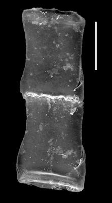 <i><i>Euconochitina symmetrica</i></i><br />Museum of Art excavation section, Kadriorg, 0.30 m, Hunneberg Stage ( 424-58)