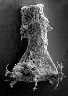 <i><i>Chitinozoa</i> | Ancyrochitina cf. paulaspina Nestor, 1994</i><br />Ohesaare borehole, 181.45 m, Jaagarahu Stage ( 272-52)