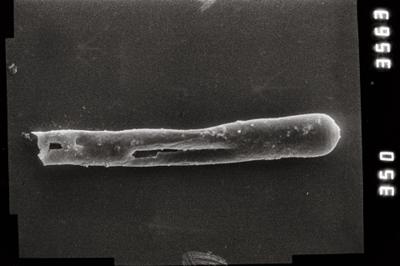 <i><i>Conochitina leptosoma</i> | Conochitina aff. leptosoma</i><br />Ruhnu 500 borehole, 392.80 m, Jaagarahu Stage ( 754-810)