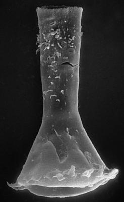 <i><i>Chitinozoa</i> | Clathrochitina aff. clathrata Eisenack, 1959</i><br />Nagli 106 borehole, 613.50 m, Adavere Stage ( 272-58)