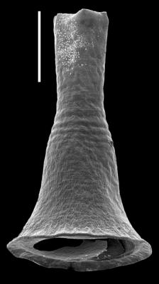 <i><i>Chitinozoa</i> | Cyathochitina cf. sebyensis Grahn, 1981</i><br />Uuga Cliff 1, Parki peninsula, 0.90 m, Lasnamägi Stage ( 590-30)
