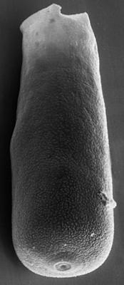 <i><i>Chitinozoa</i> | Conochitina aff. emmastensis Nestor, 1982</i><br />Varbla 502 borehole, 155.00 m, Adavere Stage ( 272-92)