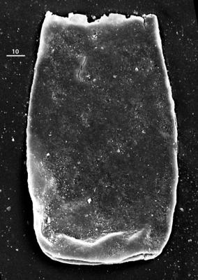 <i><i>Bursachitina</i> | Bursachitina sp.</i><br />Aizpute 41 borehole, 971.15 m, lower Silurian ( 345-14)