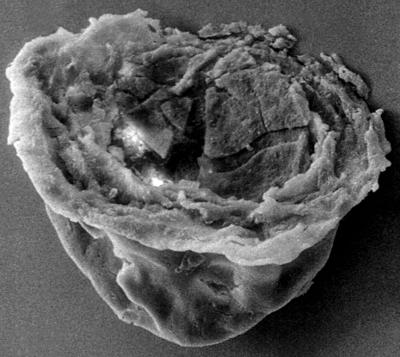 <i><i>Pterochitina macroptera</i> | Pterochitina macroptera ( Eisenack, 1959)</i><br />Pulli 1 borehole, 17.70 m, Jaani Stage ( 272-202)