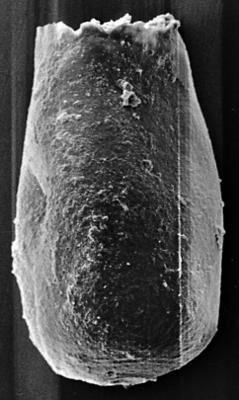 <i><i>Chitinozoa</i> | Conochitina aff. sp. 7, Nestor, 1994</i><br />Ohesaare borehole, 222.50 m, Jaagarahu Stage ( 272-147)