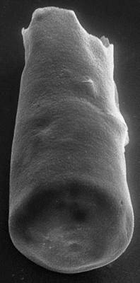 <i><i>Chitinozoa</i> | Conochitina cf. argillophila Laufeld, 1974</i><br />Ohesaare borehole, 169.50 m, Jaagarahu Stage ( 272-66)