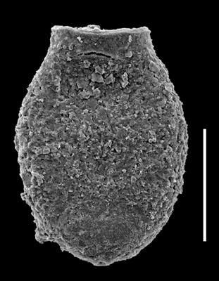 <i><i>Chitinozoa</i> | Desmochitina sp. A, aff. bulla Taugourdeau et de Jekhowsky, 1960</i><br />Museum of Art excavation section, Kadriorg, 0.30 m, Hunneberg Stage ( 424-65)