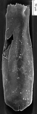 <i><i>Conochitina pachycephala</i></i><br />Ikla borehole, 234.00 m, Jaagarahu Stage ( 350-27)