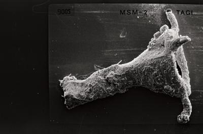 <i><i>Ancyrochitina tomentosa</i> | Ancyrochitina cf. tomentosa</i><br />Ruhnu 500 borehole, 404.20 m, Jaagarahu Stage ( 754-557)