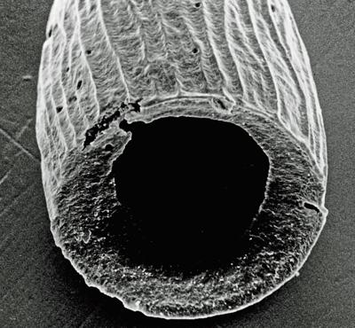<i><i>Chitinozoa</i> | Cyathochitina cf. dispar Benoit et Taugourdeau,1961</i><br />Eikla 508 borehole, 289.50 m, Nabala Stage ( 306-2)