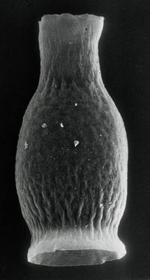 <i><i>Armoricochitina granulifera</i></i><br />Imavere 73T borehole, 215.70 m, Idavere Substage ( 190-15)