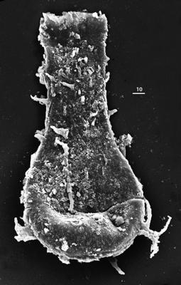 <i><i>Ramochitina</i> | Ramochitina sp.</i><br />Aizpute 41 borehole, 910.50 m, lower Silurian ( 345-33)