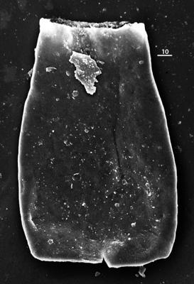 <i><i>Conochitina edjelensis</i></i><br />Aizpute 41 borehole, 971.15 m, lower Silurian ( 345-13)