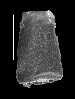 <i><i>Belonechitina micracantha</i> | Belonechitina micracantha (Eisenack)</i><br />Black Knob Ridge Section,  m, Katian ( 862-10)