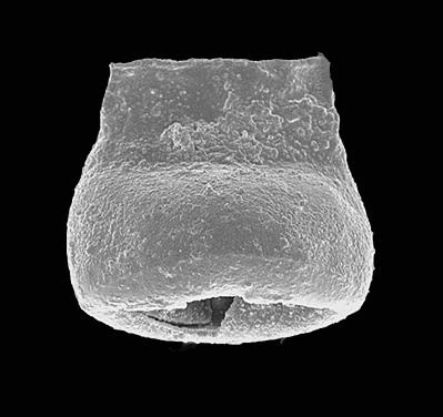 <i><i>Chitinozoa</i> | Eisenackitina sp. 2 Nestor, 2009</i><br />Pavilosta 51 borehole, 767.00 m, Gorstian ( 576-29)