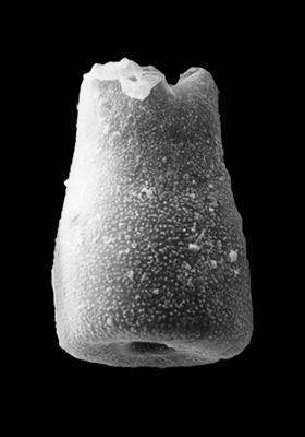 <i><i>Chitinozoa</i> | Eisenackitina sp. 1 Nestor, 2009</i><br />Pavilosta 51 borehole, 775.00 m, Gorstian ( 576-28)
