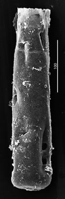 <i><i>Chitinozoa</i> | Conochitina aff. tuba Eisenack, 1932</i><br />Aizpute 41 borehole, 974.15 m, lower Silurian ( 345-11)