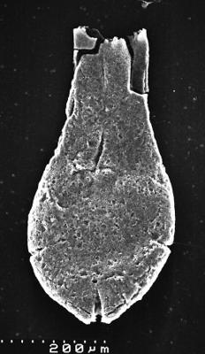<i><i>Chitinozoa</i> | Lagenochitina sp.1</i><br />Varangu stratotype outcrop,  m, Tremadocian ( 1537-3)