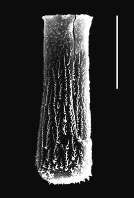<i><i>Chitinozoa</i> | Hercochitina aff. spinetum Melchin et Legault, 1985</i><br />Piilsi 729 borehole, 103.14 m, Haljala Stage ( 664-7)