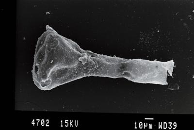 <i><i>Ancyrochitina</i> | Ancyrochitina sp.</i><br />Gussev 1 borehole, Kaliningrad oblast, 1393.00 m, Paadla Stage ( 754-61)