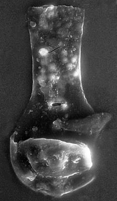 <i><i>Chitinozoa</i> | Angochitina? sp.</i><br />Remte 3 borehole, 946.40 m, Raikküla Stage ( 272-55)