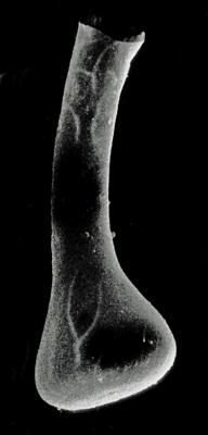 <i><i>Fungochitina fungiformis</i></i><br />Rapla borehole, 95.50 m, Nabala Stage ( 190-10)