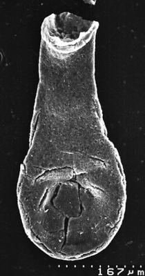 <i><i>Chitinozoa</i> | Lagenochitina sp. cf L. estonica Eisenack 1955</i><br />Varangu stratotype outcrop,  m, Tremadocian ( 1537-2)
