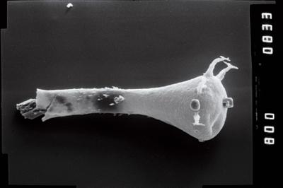 <i><i>Ancyrochitina</i> | Ancyrochitina cf. clathrospinosa</i><br />Vängla trench,  m, Adavere Stage ( 754-1910)