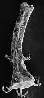 <i><i>Chitinozoa</i> | Ancyrochitina cf. ancyrea (Eisenack, 1931)</i><br />Kipi borehole, 116.80 m, Jaani Stage ( 197-7)