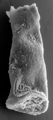 <i><i>Chitinozoa</i> | Conochitina? sp. 3 Nestor, 1984</i><br />Kirikuküla borehole, 25.60 m, Adavere Stage ( 223-23)