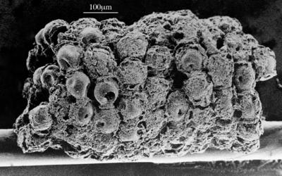 <i><i>Desmochitina nodosa</i></i><br />Ketrzyn IG-1 borehole, 1573.60 m, Idavere Substage ( 300-3)