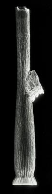 <i><i>Laufeldochitina stentor</i> | Cyathochitina stentor (Eisenack, 1937)</i><br />Rapla borehole, 167.30 m, Kukruse Stage ( 190-21)