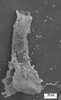 <i><i>Ancyrochitina plurispinosa</i></i><br />Staicele 4 borehole, 256.40 m, Jaagarahu Stage ( 754-1385)