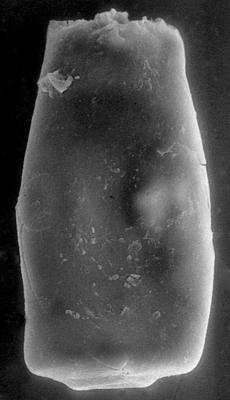 <i><i>Chitinozoa</i> | Conochitina sp. 2 Nestor, 1994</i><br />Pulli 2 borehole, 59.80 m, Adavere Stage ( 272-136)