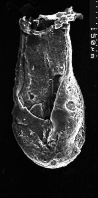 <i><i>Chitinozoa</i> | Lagenochitina sp. cf L. estonica Eisenack 1955</i><br />Varangu stratotype outcrop,  m, Tremadocian ( 1537-16)