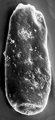 <i><i>Chitinozoa</i> | Conochitina cf. protracta (Zaslavskaya, 1980)</i><br />Ruhnu 500 borehole, 496.90 m, Raikküla Stage ( 272-122)