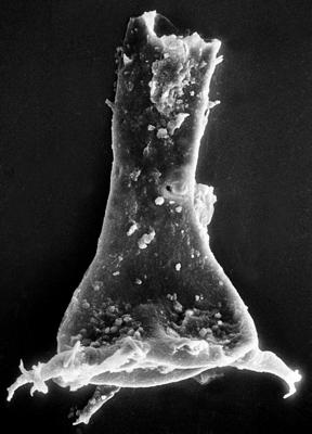 <i><i>Chitinozoa</i> | Ancyrochitina aff. ancyrea (Eisenack, 1931)</i><br />Viki borehole, 149.40 m, Adavere Stage ( 272-38)