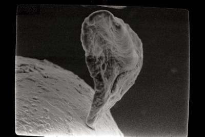 <i><i>Chitinozoa</i> | Conochitina cf. mamilla Laufeld, 1974</i><br />Kipi borehole, 115.15 m, Jaani Stage ( 272-108)