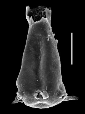 <i><i>Ancyrochitina rumbaensis</i></i><br />Paatsalu 527 borehole, 93.40 m, Llandovery ( 493-23)