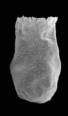 <i><i>Chitinozoa</i> | Belonechitina? granosa (Laufeld, 1974)</i><br />Ventspils D-3 borehole, 476.70 m, Ludfordian ( 576-59)