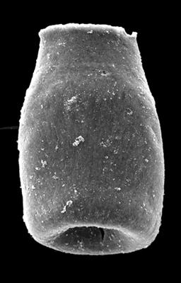 <i><i>Eisenackitina inanulifera</i></i><br />Kolka 54 borehole, 596.90 m, Adavere Stage ( 546-30)