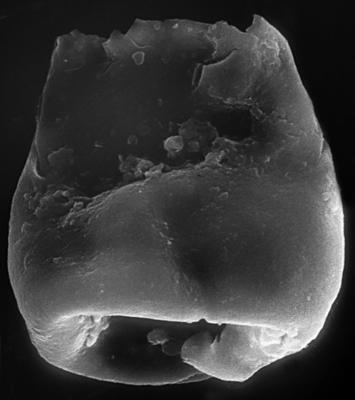 <i><i>Chitinozoa</i> | Eisenackitina? sp. 4 Nestor, 1994</i><br />Ohesaare borehole, 169.50 m, Jaagarahu Stage ( 272-177)