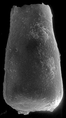<i><i>Conochitina visbyensis</i></i><br />Ohesaare borehole, 349.40 m, Adavere Stage ( 272-134)