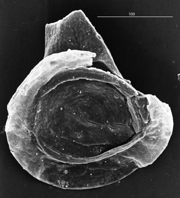 <i><i>Chitinozoa</i> | Cyathochitina cf. kuckersiana (Eisenack, 1934)</i><br />Aizpute 41 borehole, 977.95 m, lower Silurian ( 345-3)